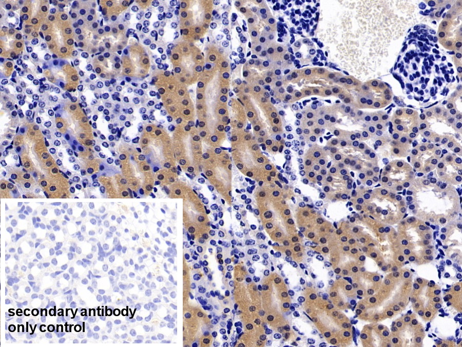 Polyclonal Antibody to Fatty Acid Binding Protein 1 (FABP1)