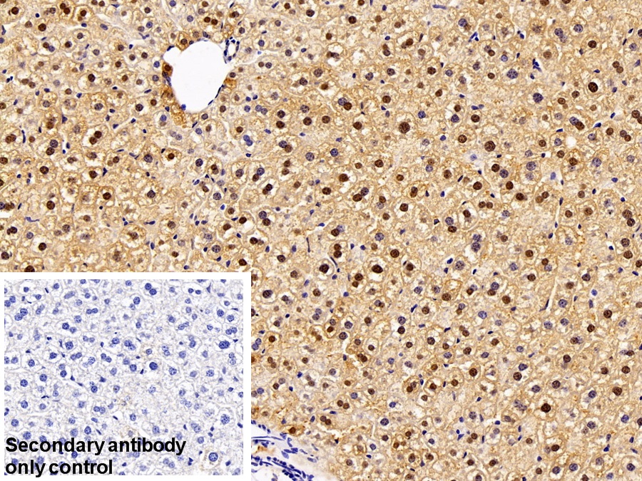Polyclonal Antibody to Fatty Acid Binding Protein 1 (FABP1)
