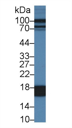 Polyclonal Antibody to Fatty Acid Binding Protein 1 (FABP1)