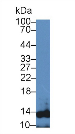 Polyclonal Antibody to Secondary Lymphoid Tissue Chemokine (SLC)