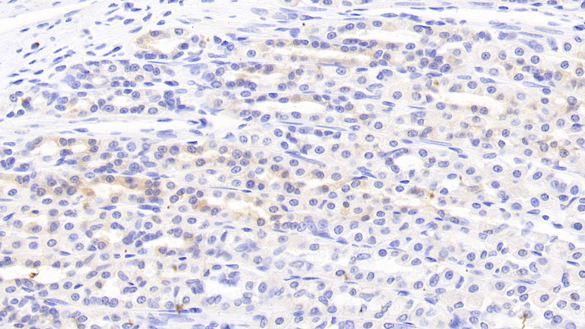 Polyclonal Antibody to Secondary Lymphoid Tissue Chemokine (SLC)