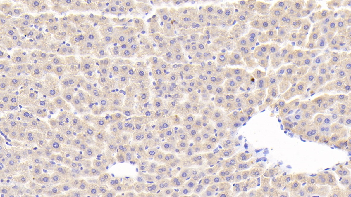 Polyclonal Antibody to Secondary Lymphoid Tissue Chemokine (SLC)