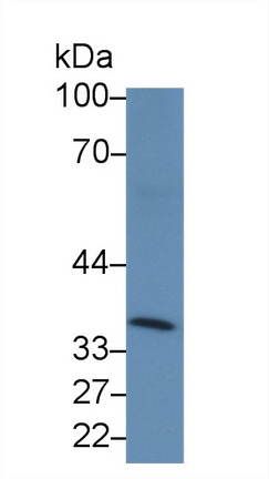 Polyclonal Antibody to Cluster Of Differentiation 2 (CD2)