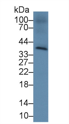 Polyclonal Antibody to Cluster Of Differentiation 2 (CD2)