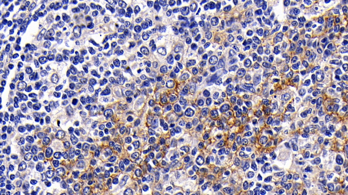 Polyclonal Antibody to Cluster Of Differentiation 23 (CD23)