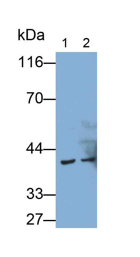 Polyclonal Antibody to Cluster Of Differentiation 23 (CD23)