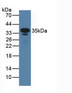 Polyclonal Antibody to Cluster Of Differentiation 23 (CD23)