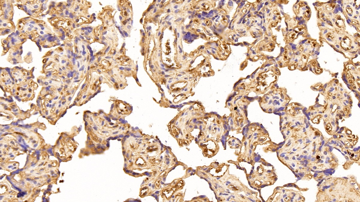 Polyclonal Antibody to Caspase 1 (CASP1)