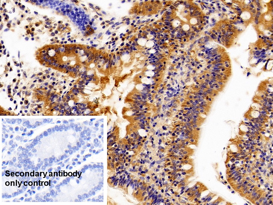 Polyclonal Antibody to Caspase 1 (CASP1)