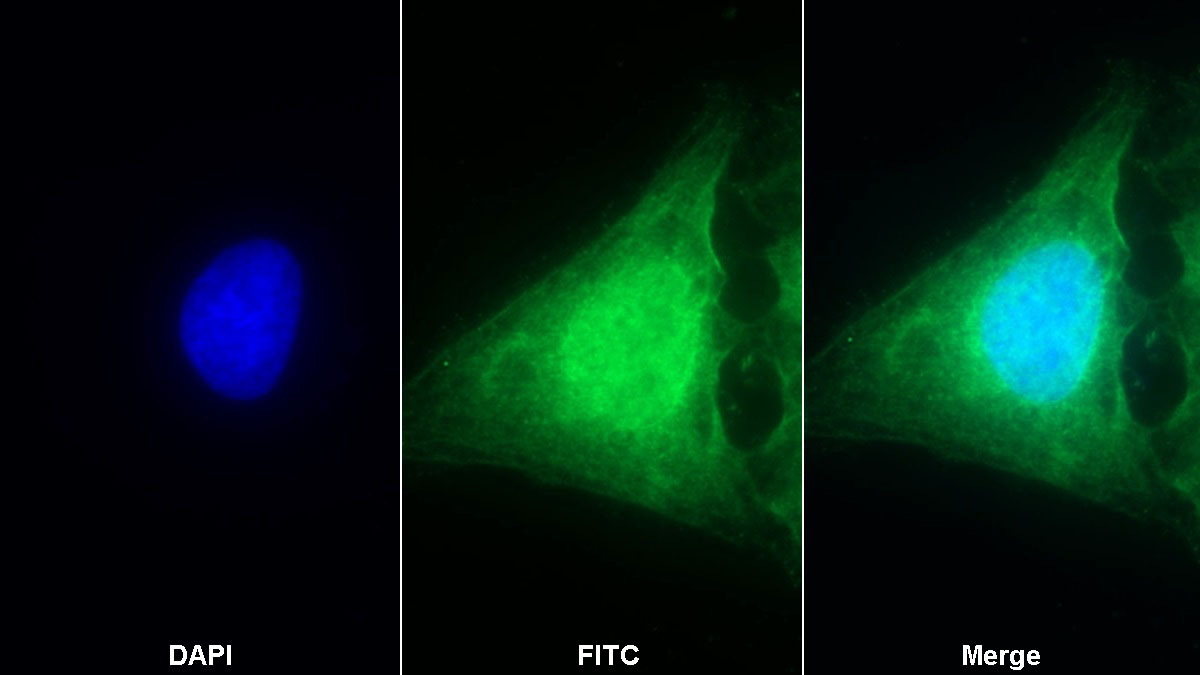 Polyclonal Antibody to Caspase 1 (CASP1)