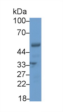 Polyclonal Antibody to Interferon Regulatory Factor 5 (IRF5)