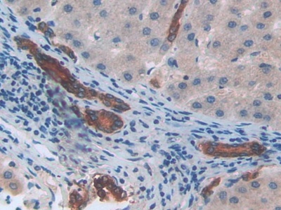 Polyclonal Antibody to Chemokine (C-X-C Motif) Ligand 2 (CXCL2)