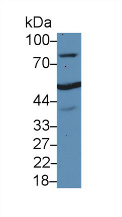 Polyclonal Antibody to Glucocorticoid Receptor (GR)