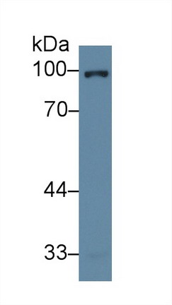 Polyclonal Antibody to Glucocorticoid Receptor (GR)