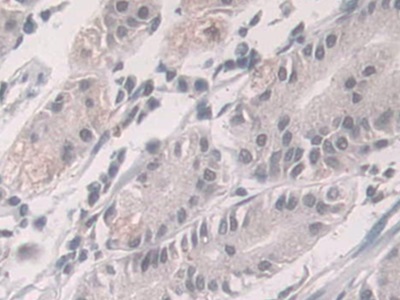 Polyclonal Antibody to Glucocorticoid Receptor (GR)