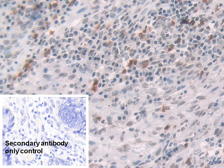 Polyclonal Antibody to Glucocorticoid Receptor (GR)