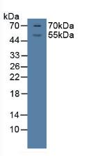 Polyclonal Antibody to Glucocorticoid Receptor (GR)