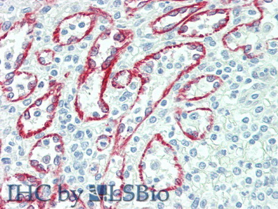 Polyclonal Antibody to Neuraminidase (NEU)