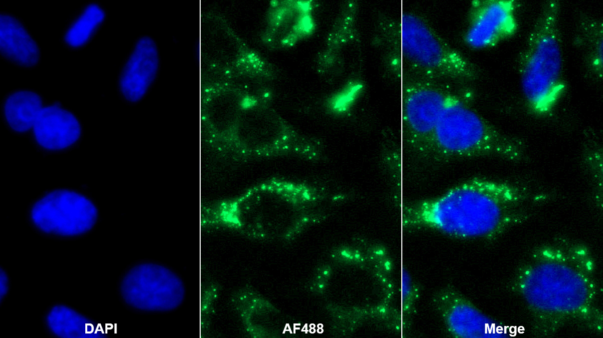 Polyclonal Antibody to Ras GTPase Activating Protein 1 (RASA1)