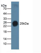 Polyclonal Antibody to Surfactant Protein C (SP-C)