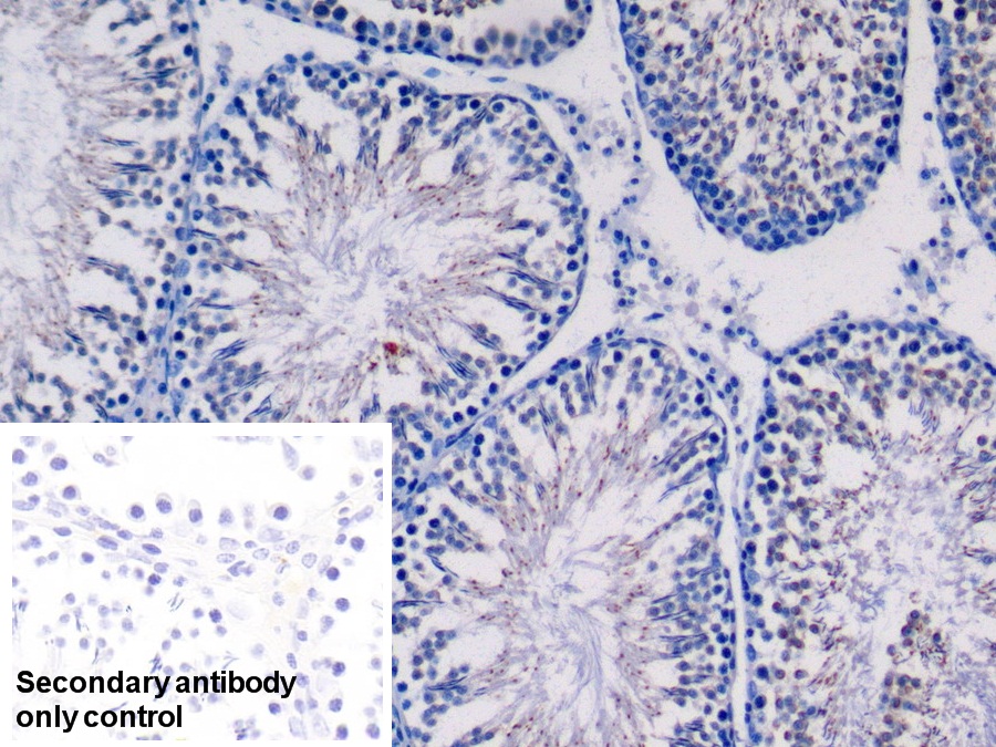 Polyclonal Antibody to Surfactant Protein C (SP-C)