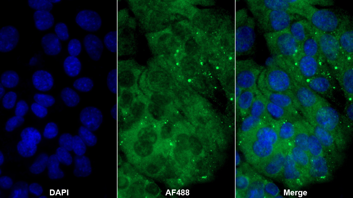 Polyclonal Antibody to Insulin Like Growth Factor 2 Receptor (IGF2R)