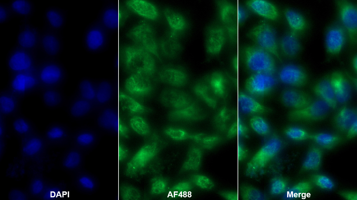 Polyclonal Antibody to MAP Kinase Activated Protein Kinase 3 (MAPKAPK3)