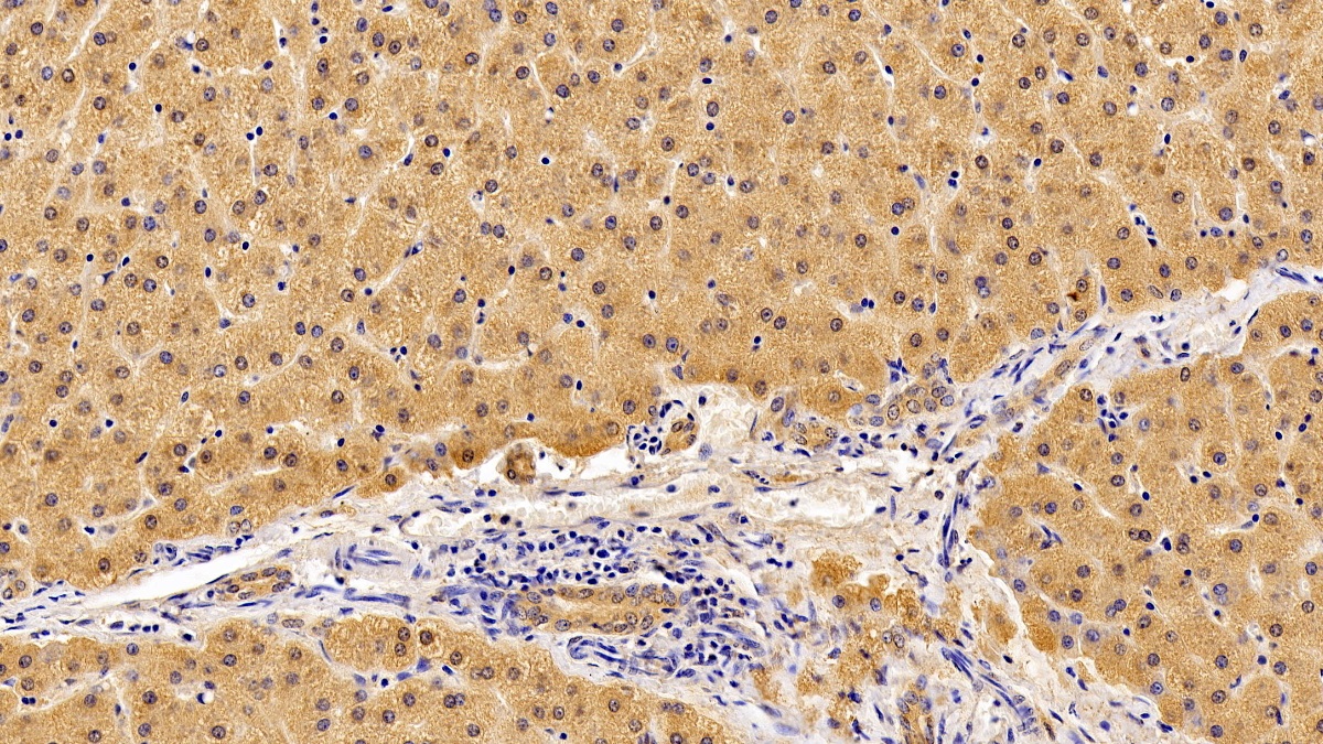 Polyclonal Antibody to Interleukin 10 Receptor Beta (IL10Rb)