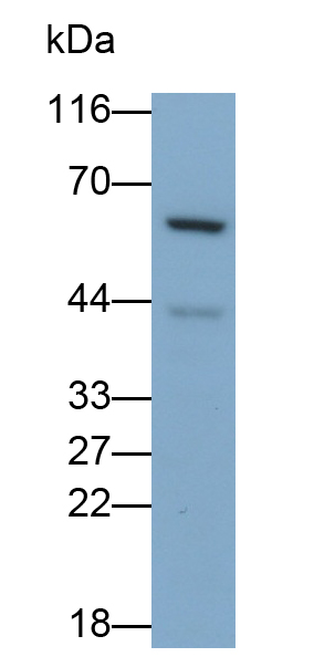 Polyclonal Antibody to Interleukin 10 Receptor Beta (IL10Rb)