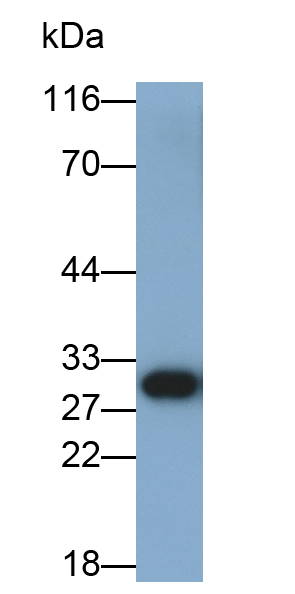 Polyclonal Antibody to Electron Transfer Flavoprotein Beta Polypeptide (ETFb)