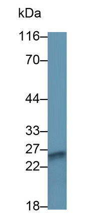 Polyclonal Antibody to Major Basic Protein (MBP)