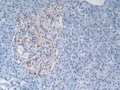 Polyclonal Antibody to Myostatin (MSTN)