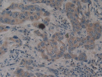 Polyclonal Antibody to Myostatin (MSTN)