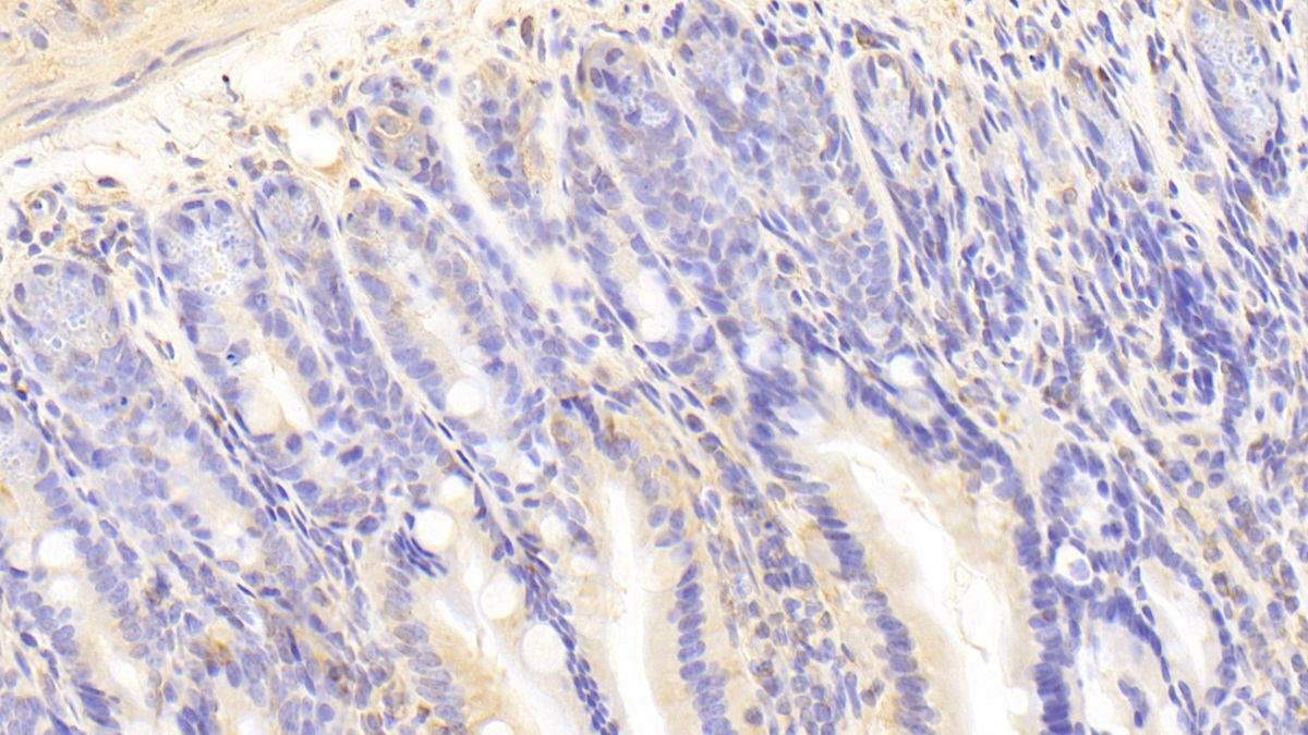 Polyclonal Antibody to Interleukin-18 Receptor Beta (IL18R Beta)