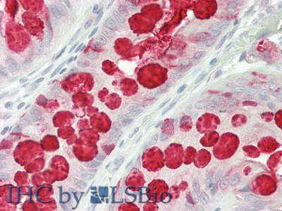 Polyclonal Antibody to Trefoil Factor 3 (TFF3)