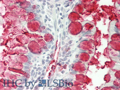 Polyclonal Antibody to Trefoil Factor 3 (TFF3)