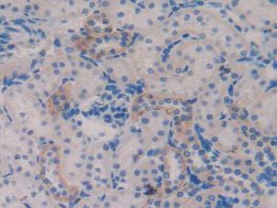 Polyclonal Antibody to Trefoil Factor 3 (TFF3)