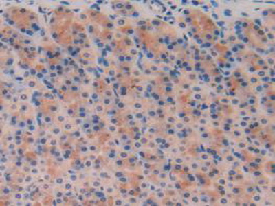 Polyclonal Antibody to Trefoil Factor 3 (TFF3)