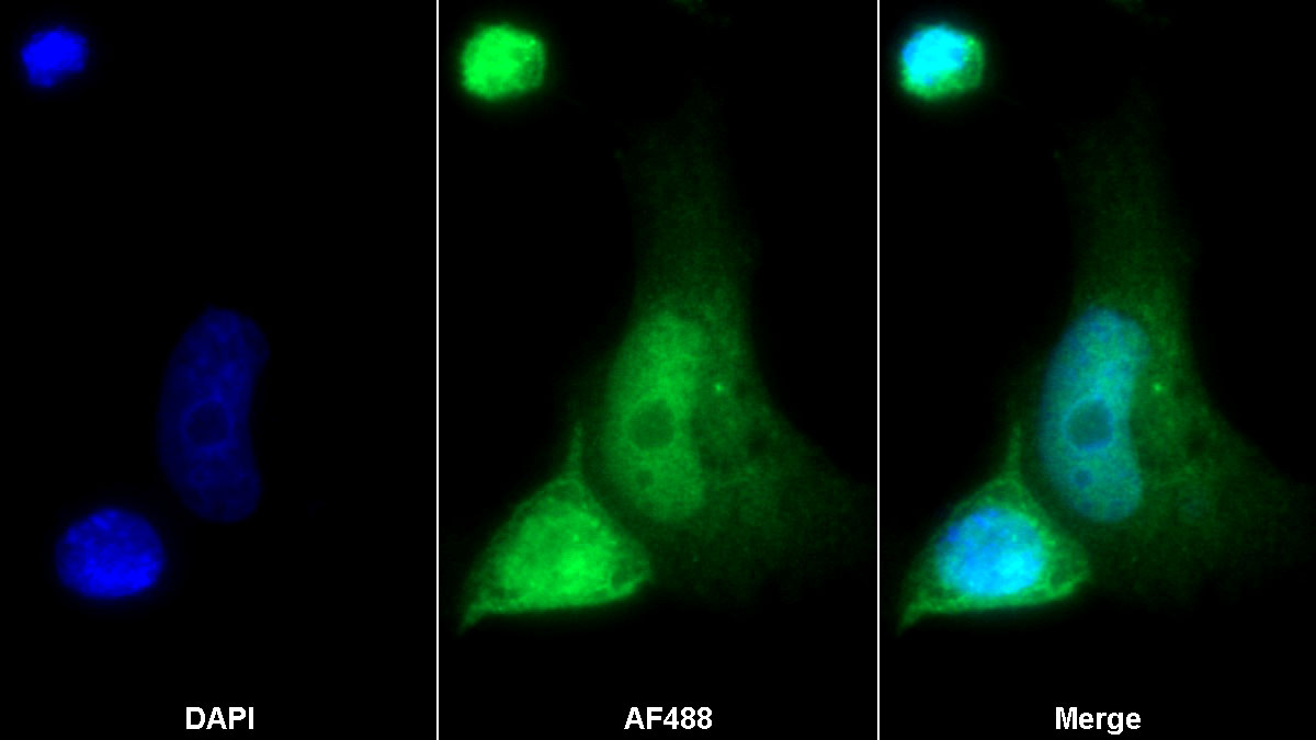 Polyclonal Antibody to Trefoil Factor 3 (TFF3)