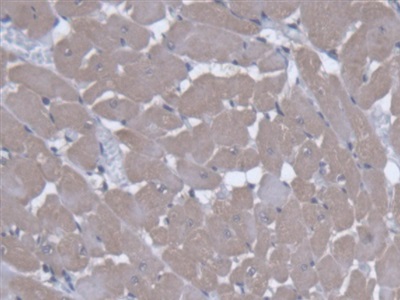 Polyclonal Antibody to Solute Carrier Family 25 Member 20 (SLC25A20)