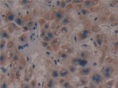 Polyclonal Antibody to Citrate Synthase (CS)