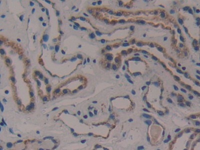 Polyclonal Antibody to Citrate Synthase (CS)