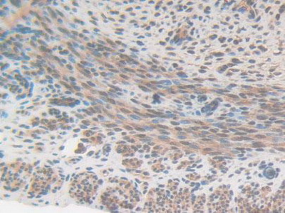 Polyclonal Antibody to Citrate Synthase (CS)