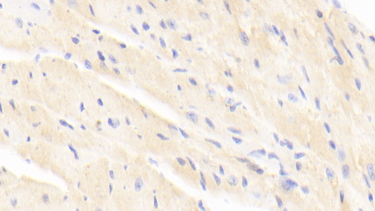 Polyclonal Antibody to Golgi Phosphoprotein 2 (GOLPH2)