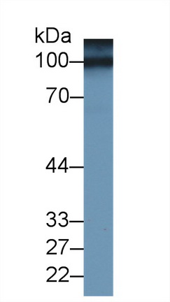 Polyclonal Antibody to Cluster Of Differentiation 146 (CD146)