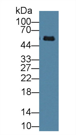 Polyclonal Antibody to Immunoglobulin G2 (IgG2)