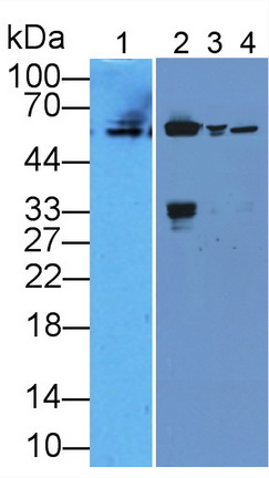 Polyclonal Antibody to Cytokeratin 10 (CK10)