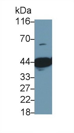 Polyclonal Antibody to Myogenic Differentiation (MyoD)