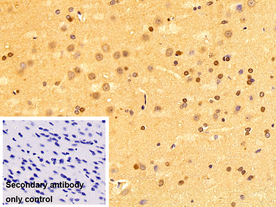 Polyclonal Antibody to Myogenic Differentiation (MyoD)