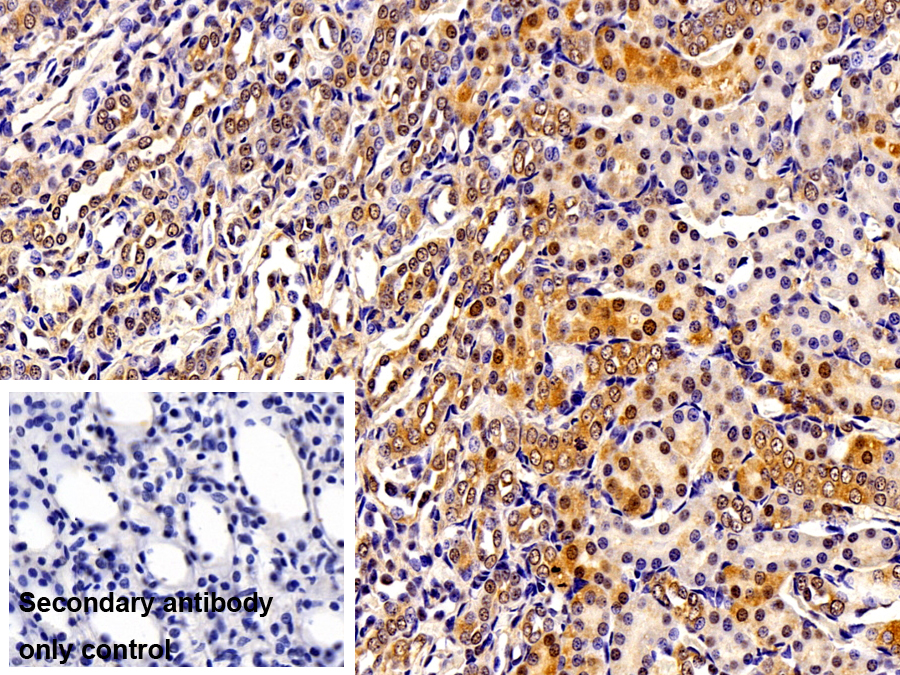 Polyclonal Antibody to Myogenic Differentiation (MyoD)